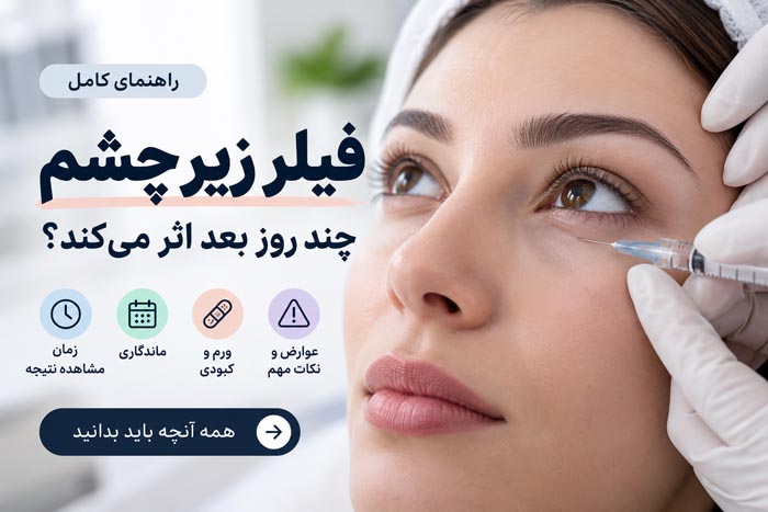 فیلر زیر چشم چند روز بعد اثر میکند؟ ماندگاری، ورم، نتیجه نهایی و عوارض 1 نتیجه فیلر زیر چشم و کاهش گودی
