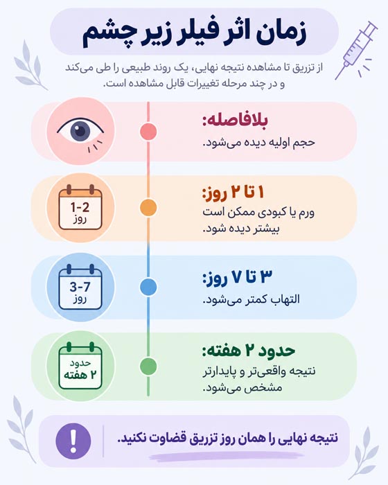 فیلر زیر چشم چند روز بعد اثر میکند؟ ماندگاری، ورم، نتیجه نهایی و عوارض 5 عوارض و ورم بعد از فیلر زیر چشم