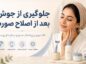 جلوگیری از جوش بعد از اصلاح صورت