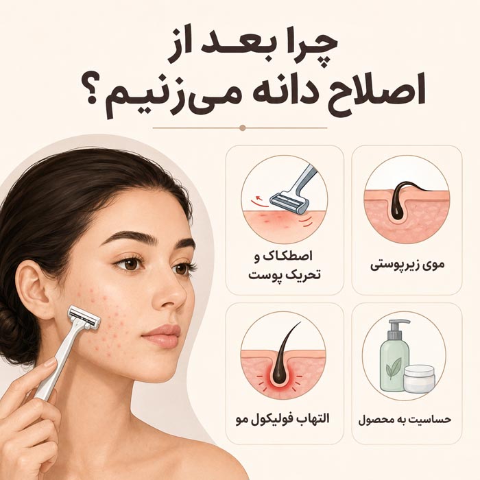 علت ایجاد دانه و جوش بعد از اصلاح شامل اصطکاک موی زیرپوستی و التهاب فولیکول