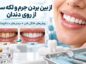 از بین بردن جرم و لکه سیگار از روی دندان؛ روشهای خانگی امن + درمانهای دندانپزشکی جرم سیگار