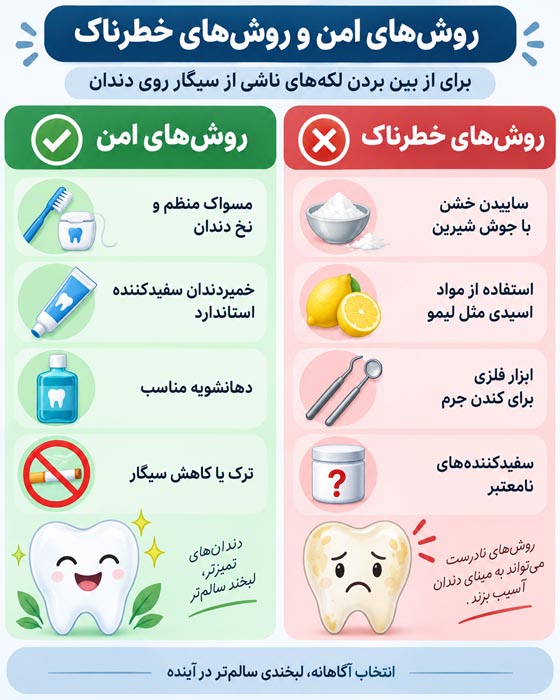 از بین بردن لکه های سیگار روی دندان