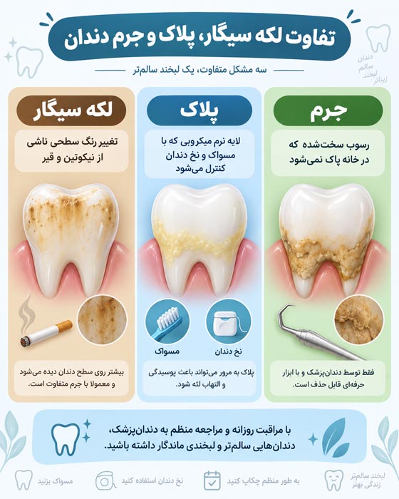 لکه پلاک سیگار و جرم دندان