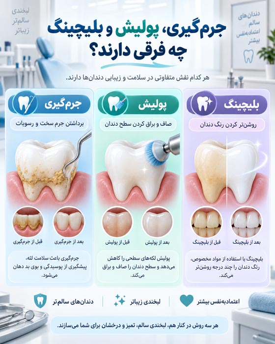 جرم گیری، پولیش و بلیچینگ دندان