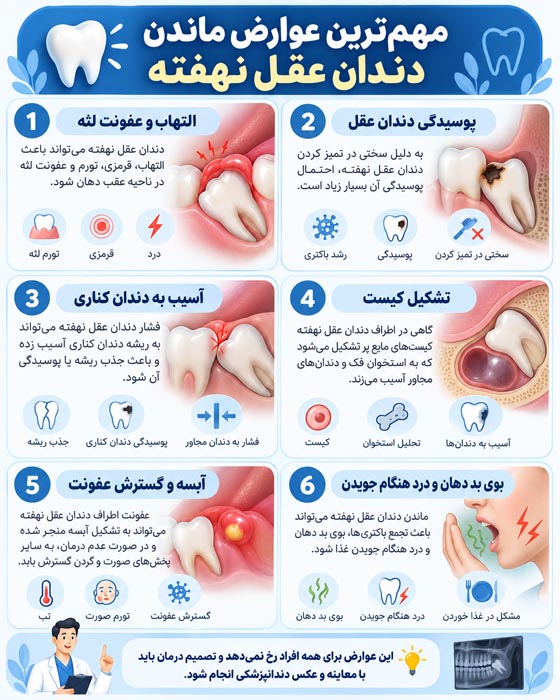 عوارض نکشیدن دندان عقل نهفته؛ علائم خطر و زمان نیاز به جراحی