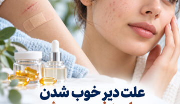 علت دیر خوب شدن جای زخم و جوش؛ نقش ویتامینها، مراقبت و زمان مراجعه علت دیر خوب شدن جای زخم و جوش