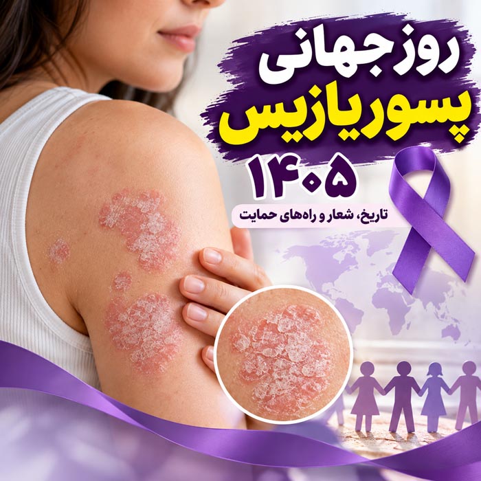 روز جهانی پسوریازیس ۱۴۰۵ و آگاهی عمومی درباره بیماری 1 روز جهانی پسوریازیس ۱۴۰۵؛ آگاهی درباره بیماری و حمایت از افراد مبتلا