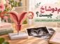 رحم دوشاخ چیست؟ راهنمای تشخیص، بارداری و انتخاب درمان رحم دوشاخ