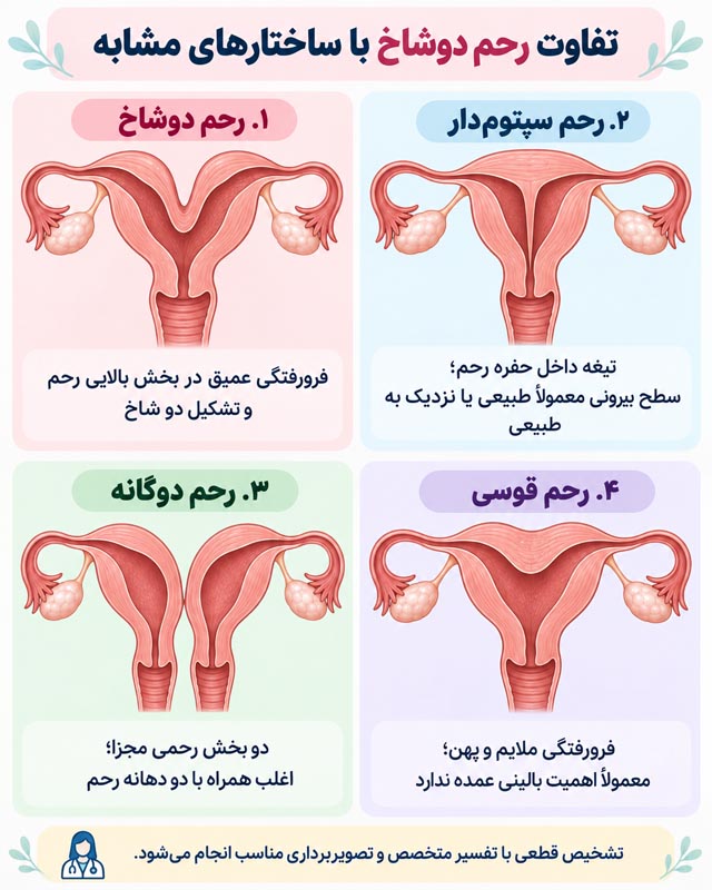 رحم دوشاخ چیست؟ راهنمای تشخیص، بارداری و انتخاب درمان 2 تصویر آموزشی مرتبط با شکل و ساختار رحم دوشاخ